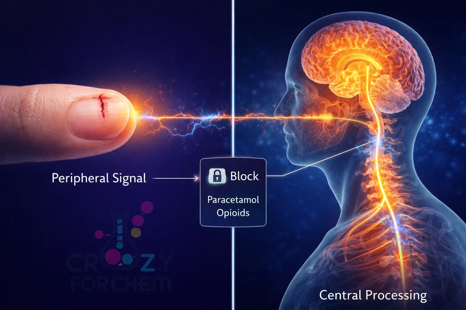 Illustration comparing peripheral pain signals at the injury site with central nervous system suppression in the brain.